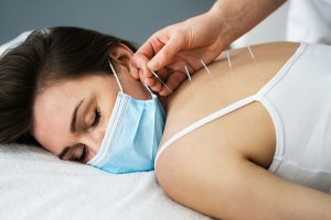 Dry Needling in Gurgaon Dry Needling in Gurgaon