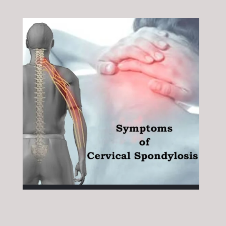 cervical spondylosis cervical spondylosis physiotherapy treatment