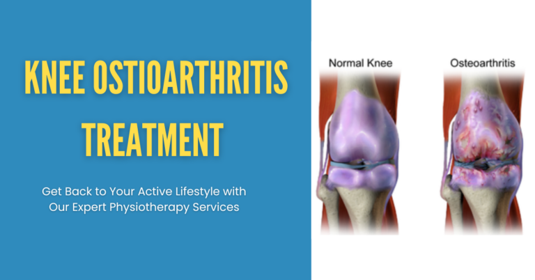 knee osteoarthritis tratment knee osteoarthritis treatment