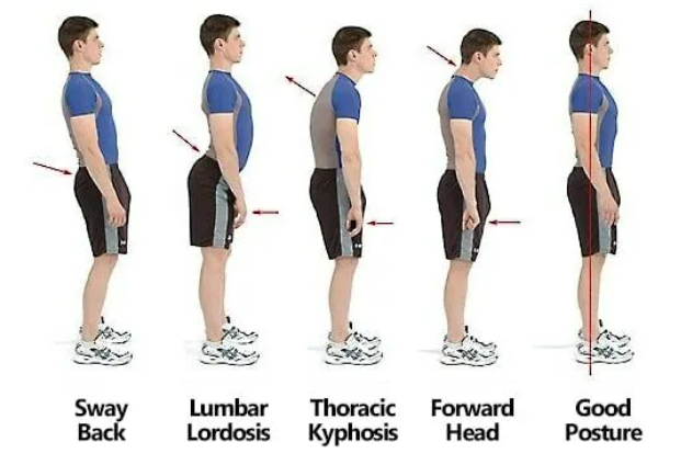 postural correction treatment postural correction tratment
