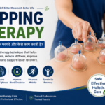 cupping therapy