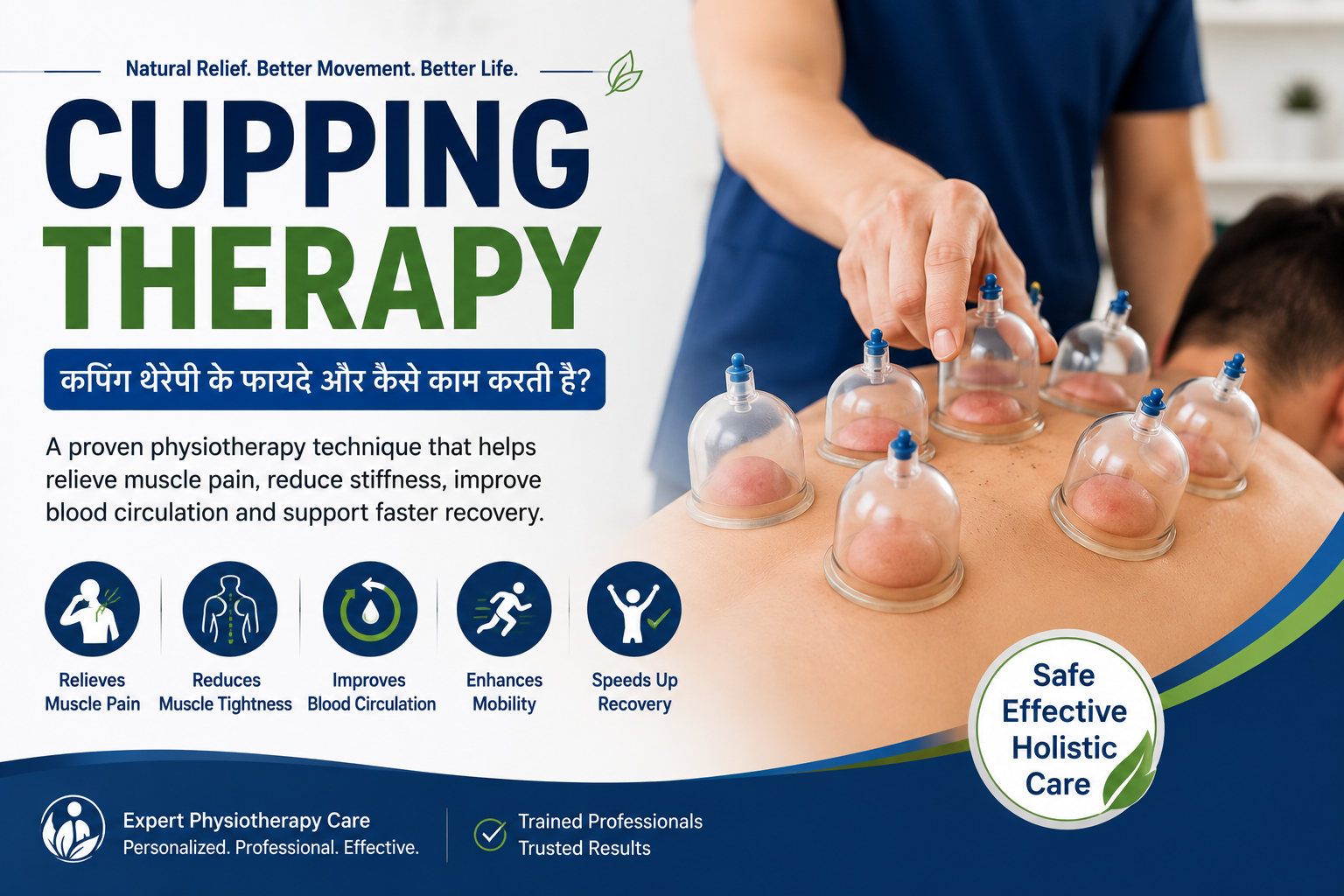 cupping therapy