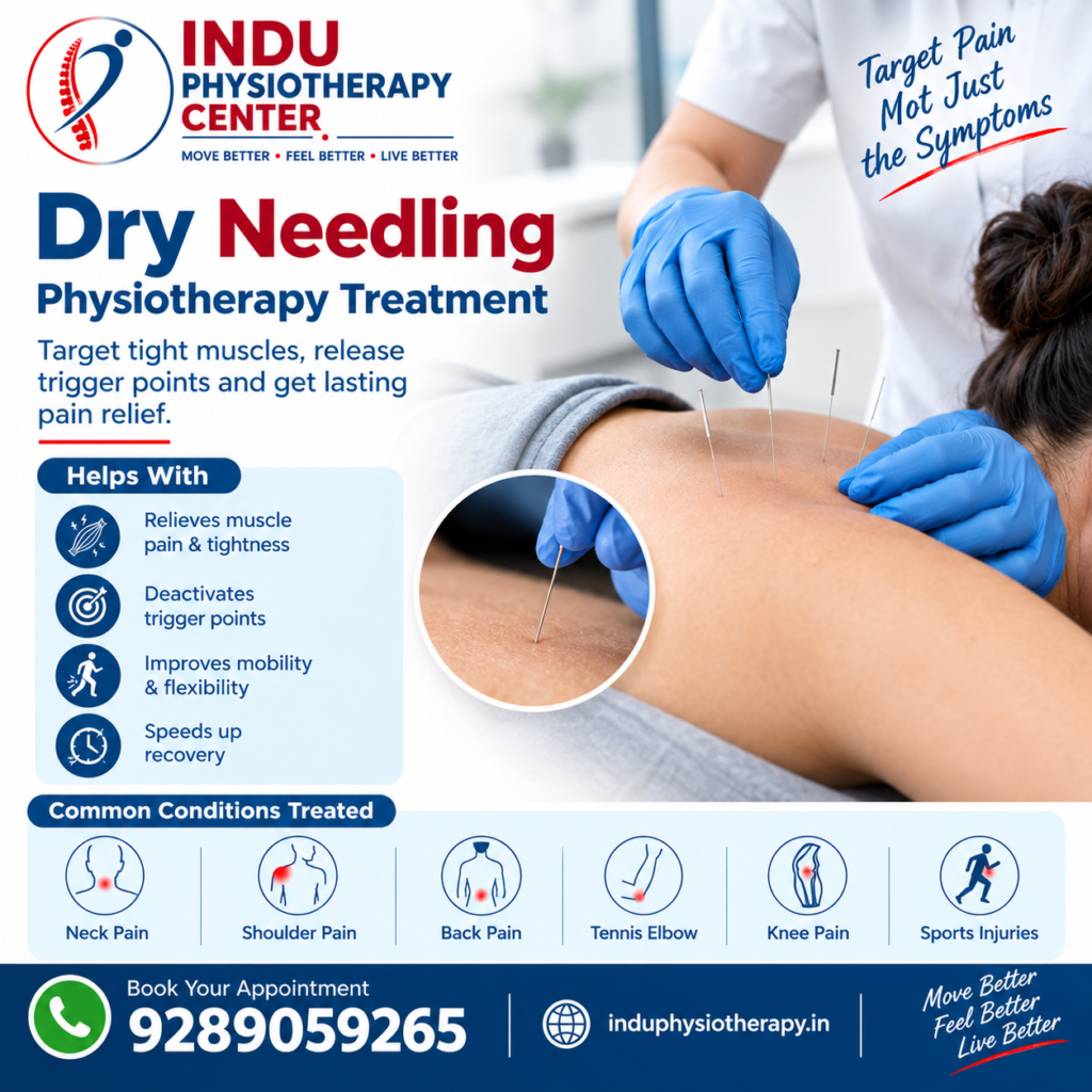 Dry needling physiotherapy clinic