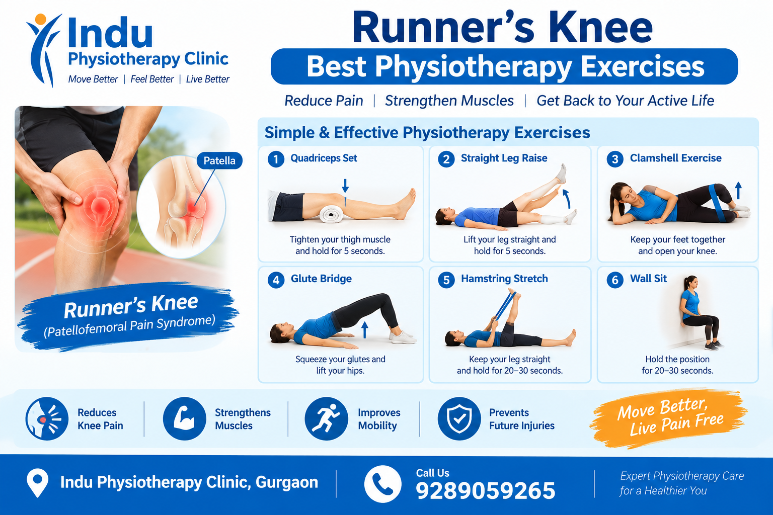Runner's Knee: Best Physiotherapy Exercises