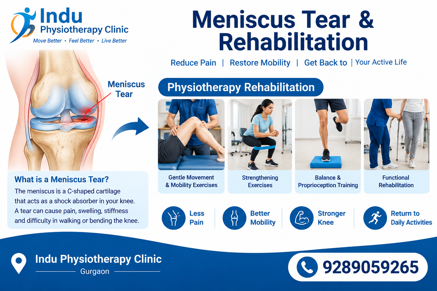 meniscus tear